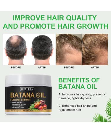  NIFEISHI Pure Batana Hair Oil Batana Oil for Hair Growth improves hair thickness prevents hair loss for men and women 120 g/4.2 FL.OZ - Buy Online on GoSupps.com