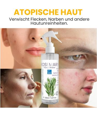 Pure Rosemary Hydrolate Spray - Antibacterial Facial & Hair Care Natural Antioxidant 200ml (1 Pack) | International Shipping - Buy Online on GoSupps.com