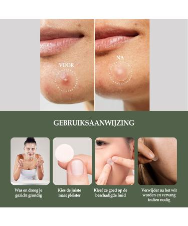 Maxideals Novabeau Acne patches for day and night pimple remover skin cleanser 144 pieces in 2 sizes pimple patches pimples that absorbs impurities - Buy Online on GoSupps.com