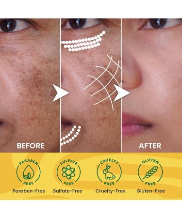 Buy Turmeric Face Mask - Vitamin C Brightening Clay - Reduce Dark Spots & Deep Cleanse - 4.2 fl oz / 120g - Ideal for All Skin Types - International Shipping Available - Buy Online on GoSupps.com