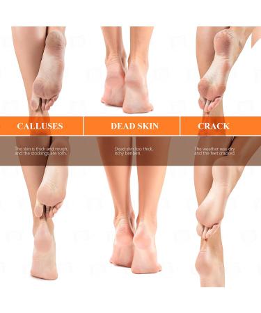 2024 Nano Foot Scrubber Callus Remover - Ultimate Foot Care Tool for Dead Skin Cracked Heels & Pedicures - Wet & Dry Use - Buy Online on GoSupps.com