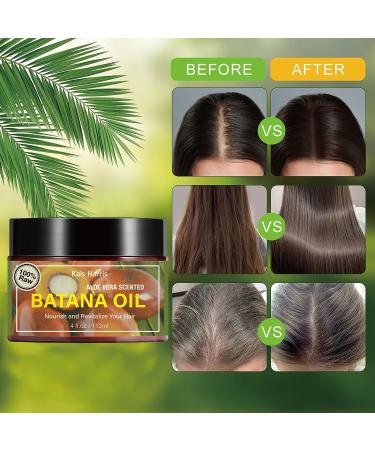 Pure Batana Oil for Hair Growth - Organic Raw & Veganic Hair Growth Oil for Dry Damaged Hair - Eliminate Split Ends Enhance Thickness Prevent Hair Loss - (112ml) - Buy Online on GoSupps.com