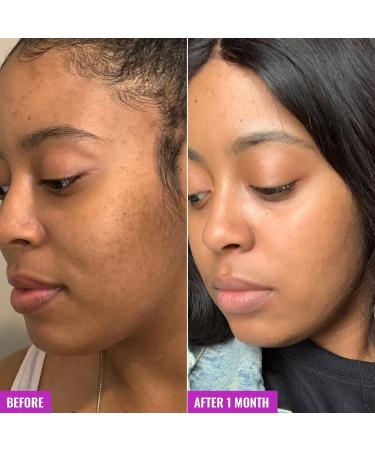 Good Molecules Glycolic Exfoliating Toner - Hyaluronic and Glycolic Acid Daily Toner for Face - Cleansing Facial Exfoliant for Glowing Even Skin Tone Skin Care - Buy Online on GoSupps.com