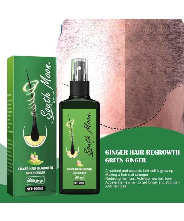 Hair Growth Serum & Lotion for Men & Women - Nourishing Hair Regrowth Treatment & Care - Buy Online on GoSupps.com