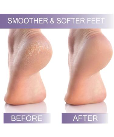 Hard Skin Exfoliator Block - Callus Remover and Cracked Heel Scrubber - Foot Pedicure Tool by Nico Stevens - Buy Online on GoSupps.com