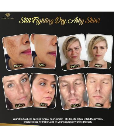 Nature's Blessing Anti-Aging Beef Tallow Cream for Fine Lines & Wrinkles | Collagen Booster Infused w/Organic Honey & Shea Butter | Deep Hydration for Youthful Glow Lavender 4 Ounce (Pack of 1) - Buy Online on GoSupps.com