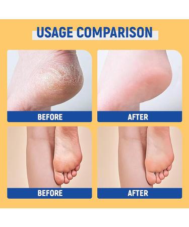 MrCuvaryas 60 Urea Cream 40 g foot care for very dry feet moisturizing and anticracking moisturizing and softening the feet cream for cracked feet heels and elbows - Buy Online on GoSupps.com