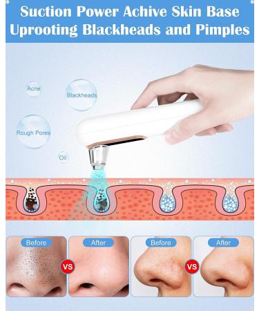 Yccu Blackhead Remover Vacuum: Professional USB Rechargeable Pore Extractor Kit - Buy Online on GoSupps.com