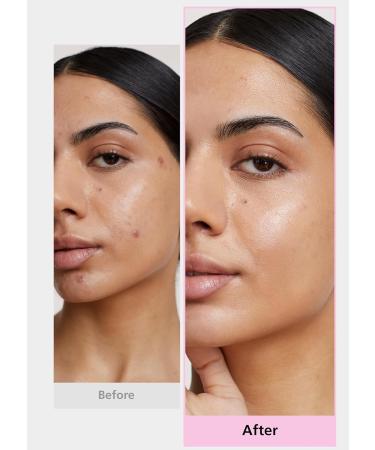 Daewoong Pharmaceutical Easyderm patch gift set 4-Type Pimple Patches - Buy Online on GoSupps.com