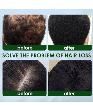 TULAMORIY Hair serum 60 ml against hair loss mens solution hair care serum hair fluid for thinning hair promotes strong and dense hair - Buy Online on GoSupps.com