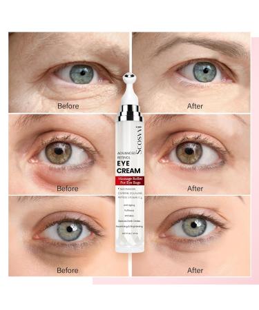 Buy Caffeine Eye Cream - Anti Aging with Niacinamide Retinol & Peptides for Dark Circles & Puffiness | Best Under Eye Treatment - Buy Online on GoSupps.com