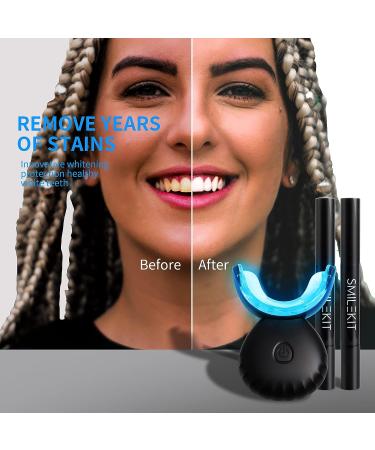 Afranti Home Wireless Teeth Whitening Kit - 16-Point LED Accelerator, Natural Whitening, Stain Removal - 4 Gel Pens, Color Card - Black - Buy Online on GoSupps.com
