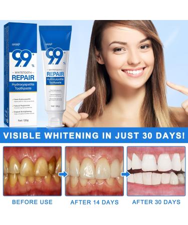 9.9% Nano Hydroxyapatite Toothpaste 2Pcs - Gum Care Strengthen Repairs Teeth and Reduces Sensitivity Provides Long-Lasting Freshness Prevent Cavities Naturally Whiter Teeth Fluoride-Free - Buy Online on GoSupps.com