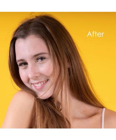 Nature Spell Activated Charcoal & Honey Purifying Face Mask 100 ml With Vitamin E Helps Remove Acne Unclog Pores & Dead Skin Cells - Made In The UK - Buy Online on GoSupps.com