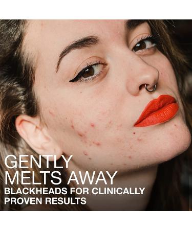 Neutrogena Blackheads Daily Acne Facial Serum | Salicylic Glycolic Acids | Oil-Free Serum for Acne-Prone Skin | Clears Clogged Pores | 1 fl. oz - Buy Online on GoSupps.com