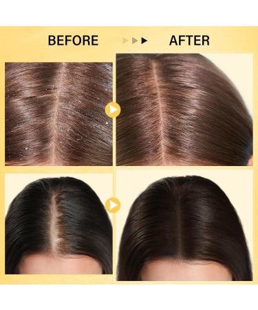 SHVYOG Ginger Scalp Scrub - Exfoliator for Build-Up Strengthening Hair Treatment with Massager 10.58 OZ - Buy Online on GoSupps.com