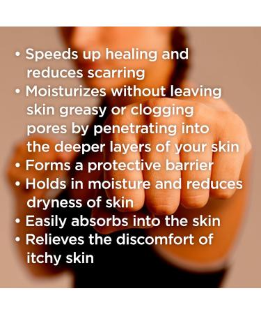 Callus Performance Quickly Heal your hand callus - Prevent callus ripping and bleeding - Designed for Gymnastics Weight-Lifting Crossfit various sports Healing Salve - Mint with Eucalyptus Mint w/ Eucalyptus 5.5 g (Pack of 1) - Buy Online on GoSupps.com