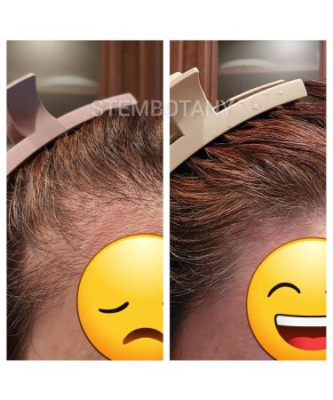 GHK-cu Copper Peptide Hair Regrowth Shampoo for Men & Women - Boost Hair Growth Nourish & Revitalize Shop Internationally - Buy Online on GoSupps.com