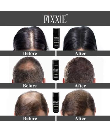 FIXXIE Hair Fibres BLACK 27.5g Bottle - Hair Fibre Concealer for Hair Loss - Thicker Looking Hair with Keratin Fibers - Men and Women - Buy Online on GoSupps.com