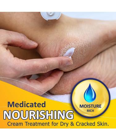 URIEL Foot Cream: Dry Cracked Heels Treatment for Women and Men - Soothing and Quick Absorbing Heel Repair Lotion - Stocking Stuffers Pack of 1 - Buy Online on GoSupps.com