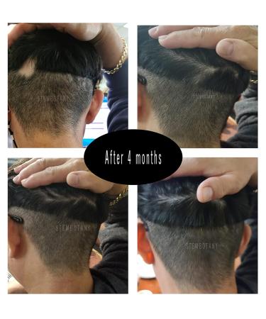 GHK-cu Copper Peptide Hair Regrowth Shampoo for Men & Women - Boost Hair Growth Nourish & Revitalize Shop Internationally - Buy Online on GoSupps.com