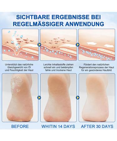 MrCuvaryas Foot Cream Stick Foot cream very dry feet calluses moisturizing foot cream very dry feet - Buy Online on GoSupps.com