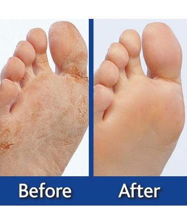 Ontel Genie Feet Exfoliating Foot Peel Cream - 4oz | Softens & Smooths Feet | Moisturizing Formula - Buy Online on GoSupps.com