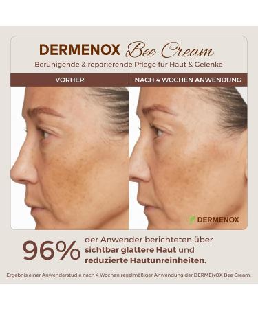 Bienengiftsalbe mit Bienengift Mit Shea Butter Menthol & Pflanzenextrakten (Arnika Teufelskralle Rosskastanie) Nat rliche Pflege & Entspannung Premium Bee Cream 100 ml - Buy Online on GoSupps.com