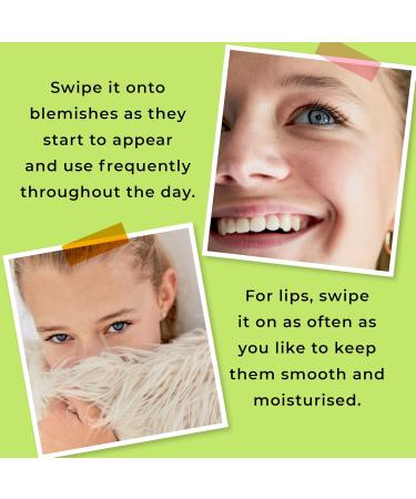 Spots & Stripes - Super Balm Spot Zapper Lip Smoother Bite Buster for Girls 100% Natural Multi-Purpose Spot Treatment and Skin Rescue for Teens in One Genius Stick with Niaouli and Coconut (15g) - Buy Online on GoSupps.com