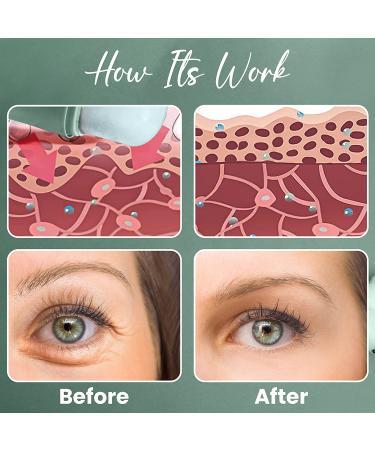 Sea Green Ice Roller for Face - Reduces Puffiness & Dark Circles, Boosts Blood Circulation for Youthful Skin - Buy Online on GoSupps.com