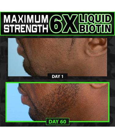 Beard Growth Kit w/ 2X Thickening Biotin Balm & Mustache Wax + Hair Growth Vitamins for Men + Grow XXL Beard Oil for Men + 6X Liquid Biotin with Collagen Peptides - Formulated in America - Buy Online on GoSupps.com