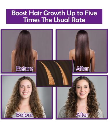 GIFBEA Hair Growth Shampoo and Conditioner Set with Rosemary Oil Serum - Biotin, Argan Oil, Castor Oil, Coconut, Keratin, Rice Water - Hair Loss Treatment for Men & Women - Buy Online on GoSupps.com
