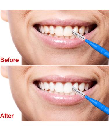 100 Interdental Brushes - Oral Hygiene Tooth Cleaning Tool - Red Blue Green Light Blue | International Shipping Available - Buy Online on GoSupps.com