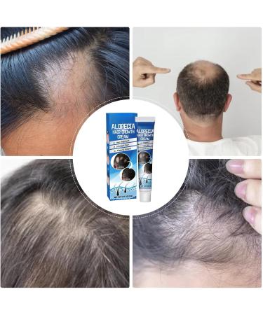  Generisch Areata Anti-Alopecia Cream - Repairing Cream for Hair Regrowth with Sophora Flavescens | Scalp Treatment for Baldness and High Hairline | Natural Formula - Buy Online on GoSupps.com