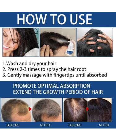 Hair Growth Serum Spray Thinned Hair Liquid Grow Hair Natural Hair Density Essential Oil Hair Growth Oil for Hair Rapid Growth and Thickening Trengthen Hair Roots Gifts for Men and Women - Buy Online on GoSupps.com