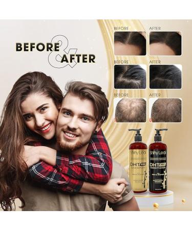 DHT Pro Shampoo & Conditioner | Advanced Formula with Procapil & Capixyl | Hair Loss Solution for Men & Women | Stimulates Follicles & Prevents Thinning Hair - Buy Online on GoSupps.com