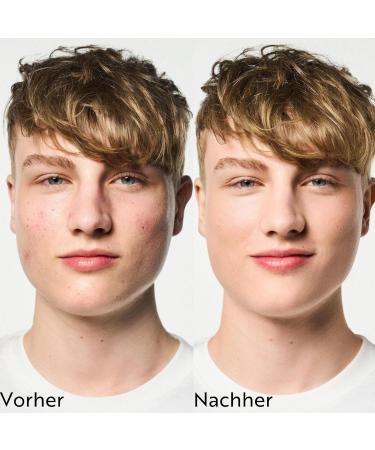  M. Asam M. Asam CLEAR SKIN Better Skin Fruit Enzyme Exfoliating (50ml) - AHA Peeling with Enzymes Gentle Fruit Acids Exfoliator for All Skin Types Exfoliating Skin Care for Clear Skin  - Buy Online on GoSupps.com