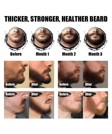 Men's Strong Beard Growth Kit - Beard Balm, Oil, Serum & Derma Roller Set for Natural Beard & Mustache Grooming - Promotes Healthy Beard Growth - Buy Online on GoSupps.com