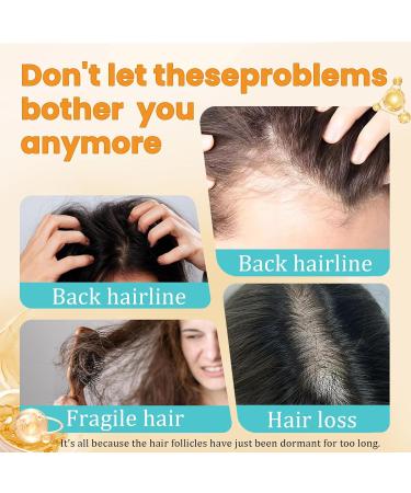 TULAMORIY 100 g Alopecia repair cream hair densifying am liorant hair loss reduces the chute thickening effect for hair improves volume hair cream for daily care for women and - Buy Online on GoSupps.com