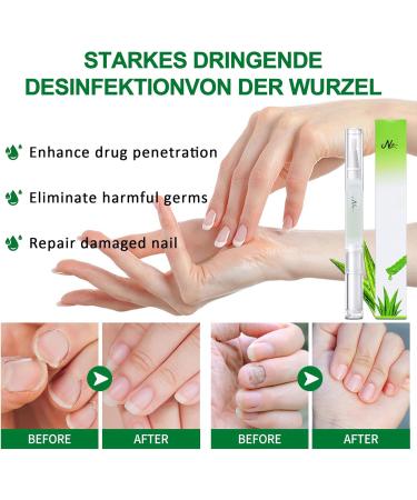 Ginger Nail Care Oil - Huile de soin des cuticules - S rum pour ongles cassants d color s et cass s - Huile de soin des ongles Ginger Cuticle Care pour ongles - Huile de soin des ongles - Soin des - Buy Online on GoSupps.com