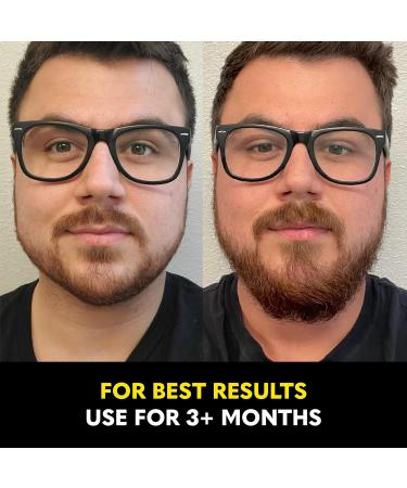 Beard Club Vitamin Spray for Facial Hair Growth | Natural Formula for Thicker Beards | Nourishing Growth Spray for All Skin Types - Buy Online on GoSupps.com