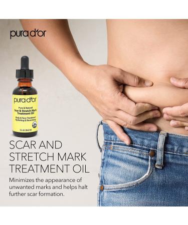 PURA DOR Organic Scar & Stretch Mark Treatment Oil | 1oz For Skin - Rosehip, Wheat Germ, Argan, Tamanu, Carrot, Rosemary, Lavender, Geranium, Patchouli, Sage - Buy Online on GoSupps.com