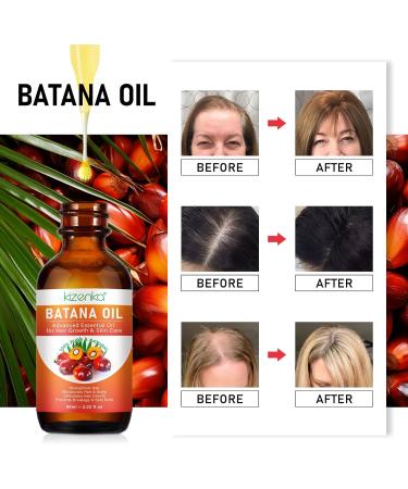 Batana Oil for Hair Growth 60ml 100% Pure & Natural Batana Oil for Healthier Thicker Fuller Hair Eliminate Hair Split Ends Prevents Hair Loss & Breakage & Skin for Men & Women 60ml (60ml) - Buy Online on GoSupps.com