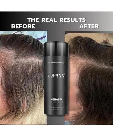 Hair Building Fibers 2-in-1 Kit - Thickening Fibers & Spray Applicator for Men & Women | Conceal Thinning Hair (Dark Brown - Buy Online on GoSupps.com