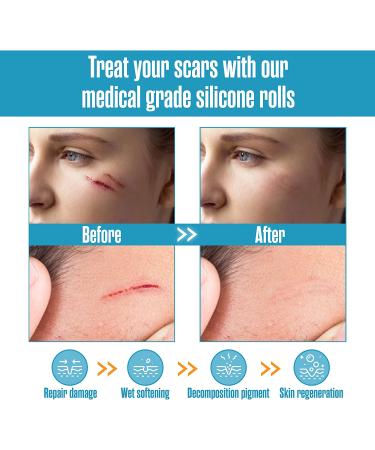 Houseables Silicone Scar Sheets Gel Tape 1.57 x 60 - Tan, Flexible Medical Grade for Surgery, Keloids, Burns - Sensitive Skin, Wound Protection - Healing Gel Patch - Buy Online on GoSupps.com