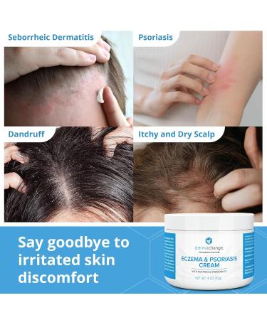 Eczema & Psoriasis Cream for Dry and Itchy Skin - Seborrheic Dermatitis Face Cream - Soothing & Hydrating - Manuka Honey & Shea Butter - Psoriasis Relief for Adults & Kids (4oz) 4 Ounce (Pack of 1) - Buy Online on GoSupps.com