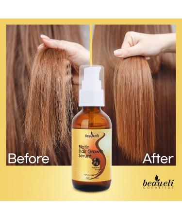 Biotin Hair Growth Serum with Castor Oil & Argan Oil | Hair Loss Prevention Treatment for Men & Women | Beaueli - Buy Online on GoSupps.com