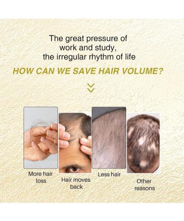 Hongjingda Rosemary Black Cumin Oil 30 ml Black Cumin Hair Growth Mist Natural Hair Growth for Damaged and Weak Hair Fermented Rice for All Hair Types - Buy Online on GoSupps.com