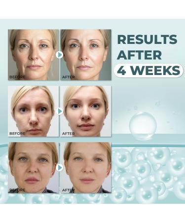 ABERA Anti-Wrinkle Face Cream Anti-Aging Moisturizer for Fine Lines & Wrinkles Hydrating Face Cream for Sensitive Skin 0.7oz - Buy Online on GoSupps.com