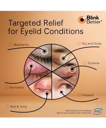 BlinkBetter Restore Eyelid Cream 3% Oat Extract & Ceramide Complex Soothing Hydration & Barrier Support for Dry, Itchy, Red, Sensitive, or Flaky Skin Around the Eyes All-Day Use 1oz - Buy Online on GoSupps.com